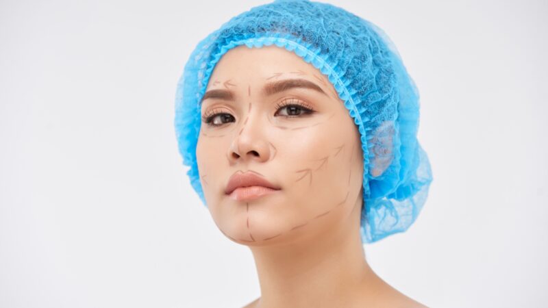 Ready for cosmetic surgery